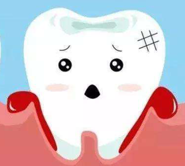 2020年牙髓干细胞治疗牙周炎需要多久？